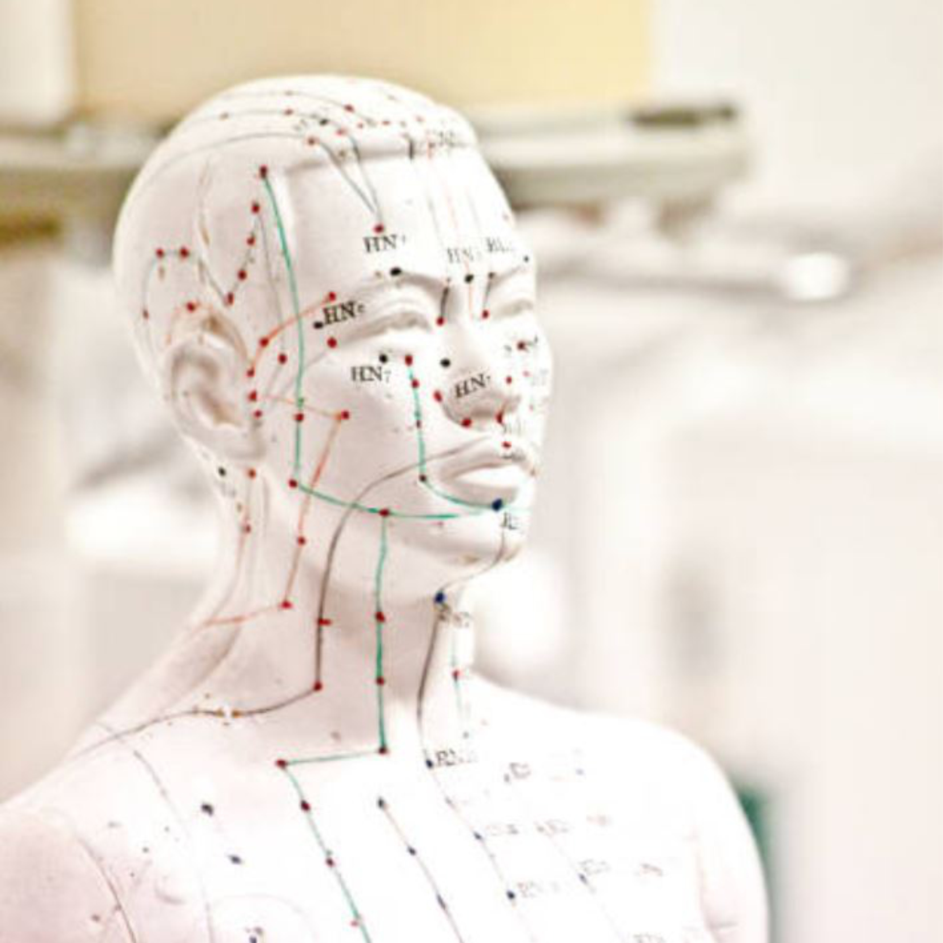 About YinYang Needling